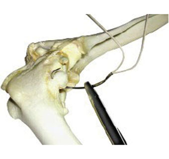 DOUBLE LINE AND NEEDLE WITH CRIMPS S 80 LB